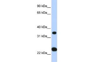 WB Suggested Anti-SLC25A35 Antibody Titration:  0. (SLC25A35 抗体  (N-Term))