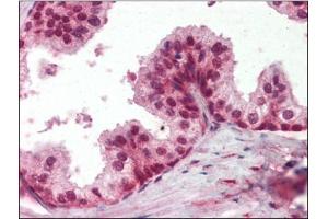 Human Prostate (formalin-fixed, paraffin-embedded) stained with PPP4Cfollowed by biotinylated secondary antibody, alkaline phosphatase-streptavidin and chromogen. (PPP4C 抗体  (C-Term))