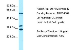 Western Blotting (WB) image for anti-Dual-Specificity tyrosine-(Y)-phosphorylation Regulated Kinase 2 (DYRK2) (C-Term) antibody (ABIN970575) (DYRK2 抗体  (C-Term))