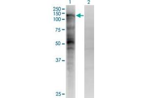Western Blot analysis of MSH2 expression in transfected 293T cell line by MSH2 monoclonal antibody (M04), clone 4F11. (MSH2 抗体  (AA 835-934))