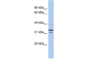 FAM92B antibody used at 1 ug/ml to detect target protein. (FAM92B 抗体  (N-Term))