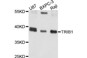 Western blot analysis of extracts of various cells, using TRIB1 antibody. (TRIB1 抗体)