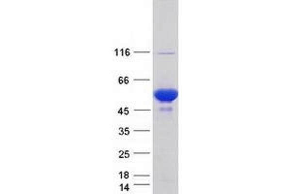 PRKAR1B Protein (Transcript Variant 3) (Myc-DYKDDDDK Tag)