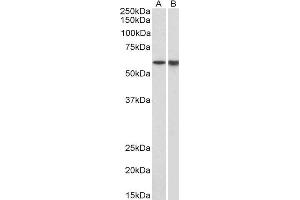 ABIN2563651 (1µg/ml) staining of Pig Bone Marrow (A) and Spleen (B) lysates (35µg protein in RIPA buffer). (LCK 抗体  (AA 39-52))