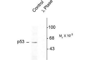 Image no. 1 for anti-Tumor Protein P53 (TP53) (pSer392) antibody (ABIN372695) (p53 抗体  (pSer392))