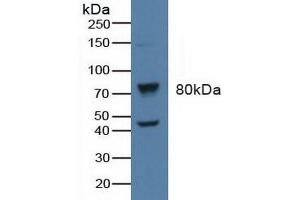 Detection of BARK in Human Raji Cells using Polyclonal Antibody to Beta Adrenergic Receptor Kinase (BARK) (beta-Adrenergic Receptor Kinase (AA 398-640) 抗体)