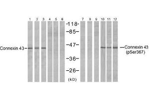 Western blot analysis of extracts from HeLa (Line 1, 4, 7 and 10), K562 (Line 2, 5, 8 and 11) and 293 (Line 3, 6, 9 and 12) cells, untreated or treated with PMA (1 η M 30min), using Connexin43 (Ab-367) antibody (E021250, Lane 1, 2, 3, 4, 5 and 6) and Connexin43 (phospho-Ser367) antibody (E011258, Lane 7, 8, 9, 10, 11 and 12). (Connexin 43/GJA1 抗体  (pSer367))