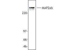 Image no. 1 for anti-Microtubule-Associated Protein 2 (MAP2) antibody (ABIN205408) (MAP2 抗体)