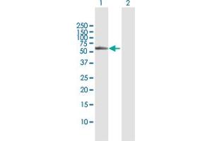 Western Blot analysis of BBS4 expression in transfected 293T cell line by BBS4 MaxPab polyclonal antibody. (BBS4 抗体  (AA 1-519))