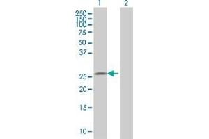 Lane 1: MIER1 transfected lysate ( 17. (MIER1 293T Cell Transient Overexpression Lysate(Denatured))