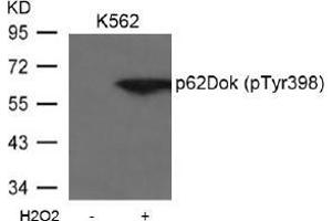 Image no. 2 for anti-Docking Protein 1, 62kDa (Downstream of tyrosine Kinase 1) (DOK1) (pTyr398) antibody (ABIN197043) (DOK1 抗体  (pTyr398))