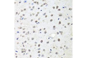 Immunohistochemistry of paraffin-embedded mouse brain using AGO2 antibody (ABIN5974124) at dilution of 1/100 (40x lens). (AGO2 抗体)