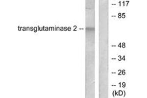 Western blot analysis of extracts from HuvEc cells, using Transglutaminase 2 Antibody. (Transglutaminase 2 抗体  (AA 1-50))