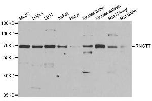 Western blot analysis of extracts of various cell lines, using RNGTT antibody. (RNGTT 抗体  (AA 1-260))