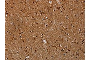 The image on the left is immunohistochemistry of paraffin-embedded Human brain tissue using ABIN7191558(MYBBP1A Antibody) at dilution 1/40, on the right is treated with synthetic peptide. (MYBBP1A 抗体)