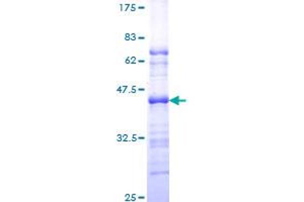 PML Protein (AA 411-510) (GST tag)