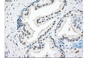 Immunohistochemical staining of paraffin-embedded lung tissue using anti-SSBmouse monoclonal antibody. (SSB 抗体)