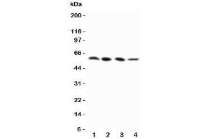 Western blot testing of RIP3 antibody and Lane 1:  PANC;  2: SW620;  3: SKOV-3;  4: M231 cell lysate (MPRIP 抗体  (N-Term))