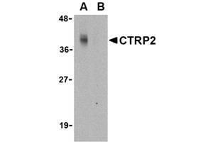 Image no. 1 for anti-C1q and Tumor Necrosis Factor Related Protein 2 (C1QTNF2) (N-Term) antibody (ABIN207816) (C1QTNF2 抗体  (N-Term))