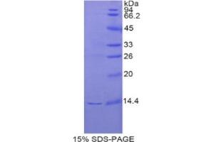 SDS-PAGE analysis of Rat REG3G Protein. (REG3g 蛋白)