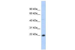 CD40 antibody used at 1 ug/ml to detect target protein. (CD40 抗体  (N-Term))