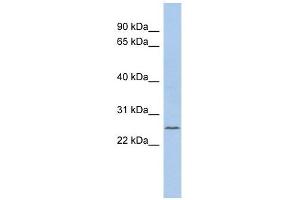 C11ORF53 antibody used at 1 ug/ml to detect target protein. (C11orf53 抗体  (Middle Region))