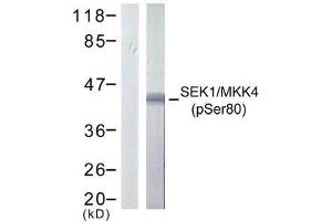 Western blot analysis of extract from 293 cells treated or untreated with UV, using SEK1/ MKK4 (phospho-Ser80) antibody (E011177). (MAP2K4 抗体  (pSer80))