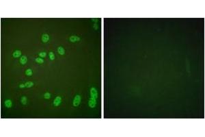 Immunofluorescence analysis of HeLa cells treated with PMA 125ng/ml 30', using POLR2A (Phospho-Ser1619) Antibody. (POLR2A/RPB1 抗体  (pSer1619))