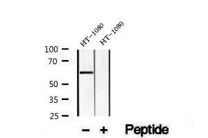 Western blot analysis of extracts of HT-1080 Jurkat cells, using KLF4 Antibody. (KLF4 抗体)