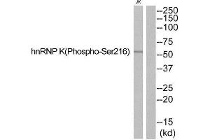 Western Blotting (WB) image for anti-Heterogeneous Nuclear Ribonucleoprotein K (HNRNPK) (pSer216) antibody (ABIN1847785) (HNRNPK 抗体  (pSer216))