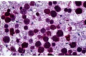 Human Testis: Formalin-Fixed, Paraffin-Embedded (FFPE) (FADS1 抗体  (AA 1-100))