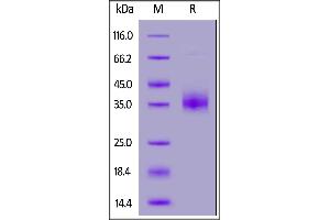 Cynomolgus NKp46, His Tag on  under reducing (R) condition. (NCR1 Protein (AA 22-257) (His tag))