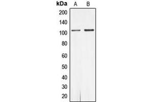 Western blot analysis of Androgen Receptor (pS650) expression in MCF7 (A), rat heart (B) whole cell lysates. (Androgen Receptor 抗体  (pSer650))