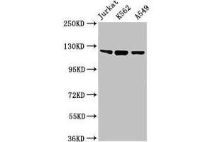 Western Blot Positive WB detected in: Jurkat whole cell lysate, K562 whole cell lysate, A549 whole cell lysate All lanes: Tlr7 antibody at 2 μg/mL Secondary Goat polyclonal to rabbit IgG at 1/50000 dilution Predicted band size: 122 kDa Observed band size: 122 kDa (TLR7 抗体  (AA 27-348))