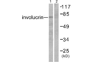 Western blot analysis of extracts from HuvEc cells, using Involucrin antibody (#C0236). (Involucrin 抗体)