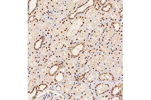 Immunohistochemistry of paraffin embedded human kidney using PAX2 (ABIN7074974) at dilution of 1:1000 (200x lens) (PAX2A 抗体)