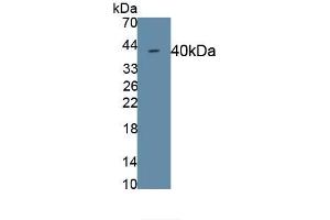 Detection of Recombinant CDH5, Rat using Monoclonal Antibody to Cadherin 5 (CDH5) (Cadherin 5 抗体  (AA 59-382))