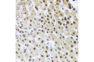 Immunohistochemistry of paraffin-embedded human liver injury using RAD23B antibody. (RAD23B 抗体  (AA 50-150))