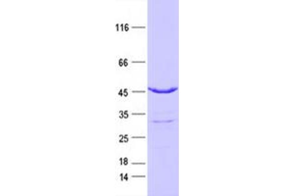 IDH2 Protein (DYKDDDDK Tag)