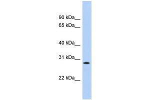 WB Suggested Anti-KCTD17 Antibody Titration:  0. (KCTD17 抗体  (Middle Region))