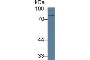 Western blot analysis of Human HepG2 cell lysate, using Mouse TGFbR2 Antibody (1 µg/ml) and HRP-conjugated Goat Anti-Rabbit antibody ( (TGFBR2 抗体  (AA 209-590))