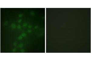 Immunofluorescence analysis of HuvEc cells, using Telomerase (Phospho-Ser227) Antibody. (TERT 抗体  (pSer227))