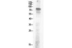 Western Blot (WB) analysis of HepG2 cells using Acetyl-Ub (K29) Polyclonal Antibody. (Ubiquitin 抗体  (acLys29))