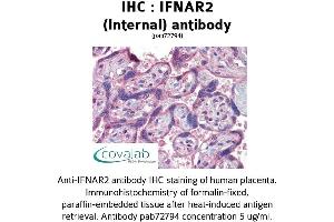 Image no. 1 for anti-Interferon alpha/beta Receptor 2 (IFNAR2) (Internal Region) antibody (ABIN1735773) (IFNAR2 抗体  (Internal Region))