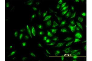 Immunofluorescence (IF) image for anti-Nucleoside diphosphate kinase B (NME2) (AA 51-152) antibody (ABIN518376)