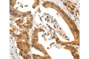 Immunohistochemistry (IHC) image for anti-Serotonin Receptor 3A (HTR3A) antibody (ABIN2427713) (Serotonin Receptor 3A 抗体)