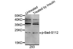Western blot analysis of extracts of 293 cell line, using Phospho-Bad-S112 antibody (ABIN5969873). (BAD 抗体  (pSer75))