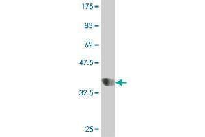 Western Blot detection against Immunogen (37. (GOLM1 抗体  (AA 302-401))