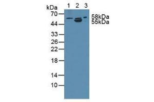 Western blot analysis of (1) Human PC-3 Cells, (2) Porcine Intestine Tissue and (3) Rat Prostate Gland Tissue. (ANTXR2 抗体  (AA 34-318))