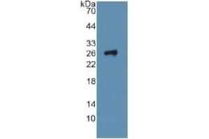 Western Blotting (WB) image for Integrin alpha 2 (ITGA2) ELISA Kit (ABIN6720453)